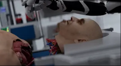 ¿Cómo funcionarán los trasplantes de cabeza? La ciencia apuesta por robots e IA | VIDEO