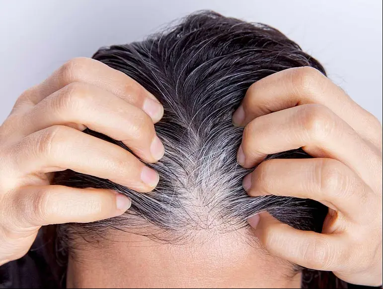¿Por qué salen canas? Tips para evitarlas | Canva